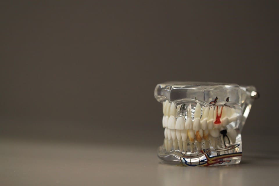 INVISALIGN en salamanca