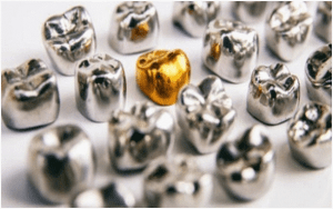 corona dental metalica