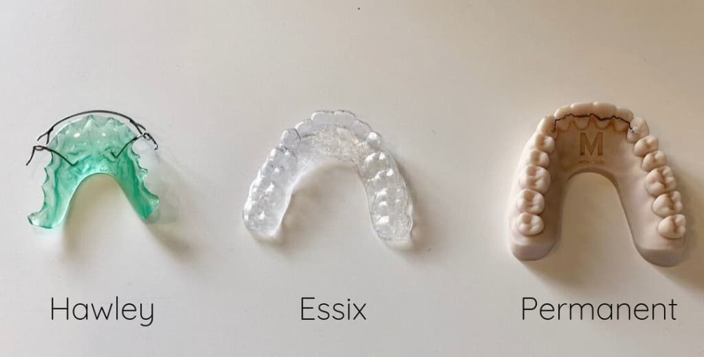 tipos de retenedores dentales