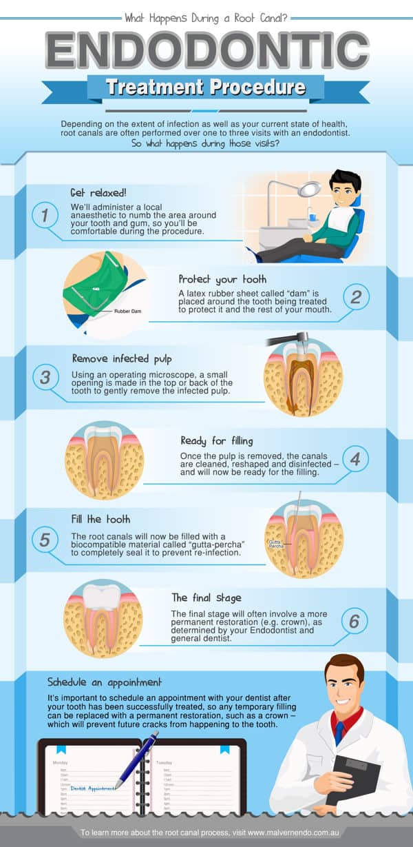 C&oacute;mo saber cu&aacute;ndo necesitas una endodoncia infografia
