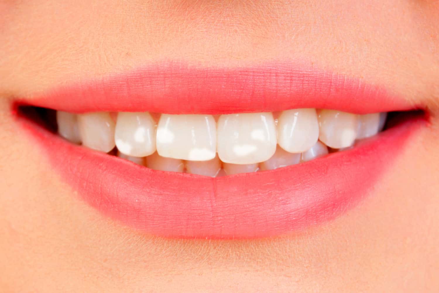Qué son las manchas blancas en los dientes? » Clinica Dental Urbina en  Salamanca