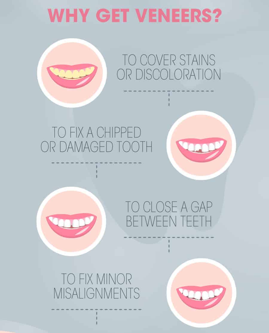 por que usar carillas dentales