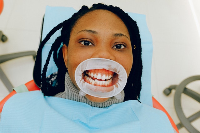 blanqueamiento dental por fotoactivacion