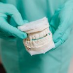 conoce todo sobre la resina dental