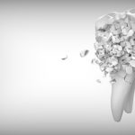 Qué hacer si tengo un agujero en el diente