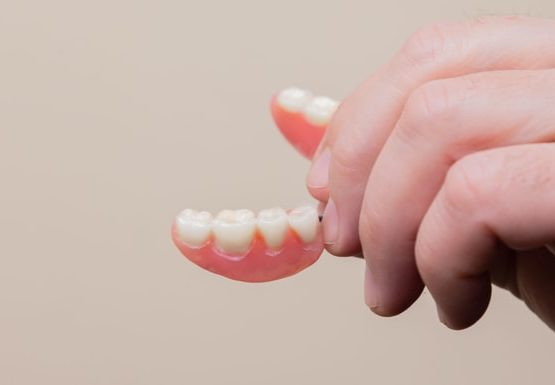 implantes caida de los dientes