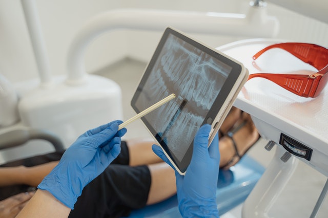 protrusion dental