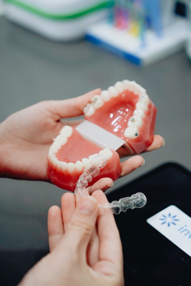 limpiar ortodoncia invisalign