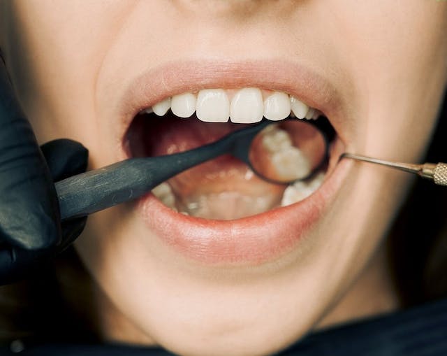 10 consejos para una salud dental óptima