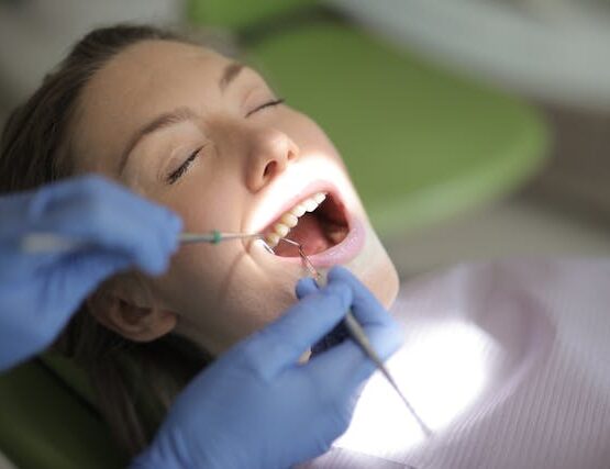 limpieza dental para prevenir retraccion de encias