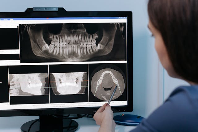 dolor Articulacion temporomandibular