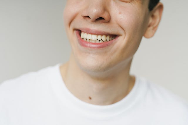 sonrisa atm