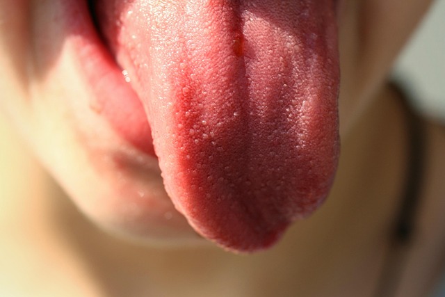 Candidiasis oral causas