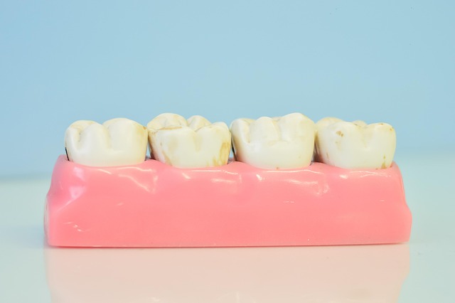 como quitar el sarro de los dientes