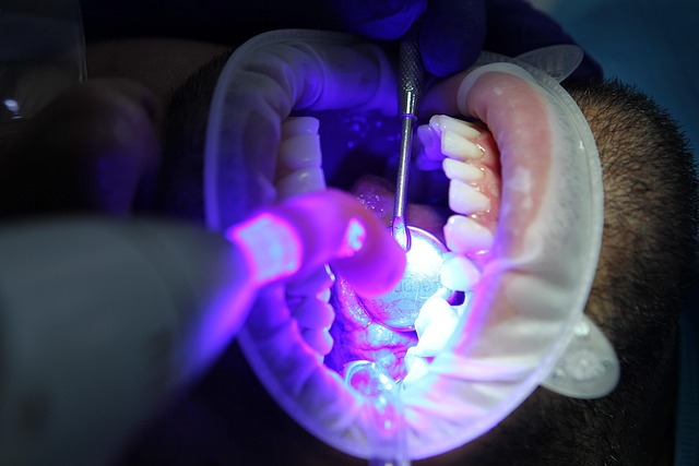 limpieza quitar sarro de los dientes
