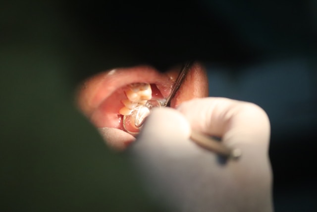 Fístula dental